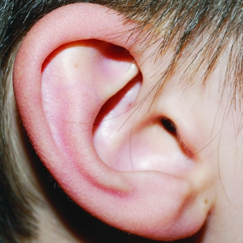 Acupuntura Auricular